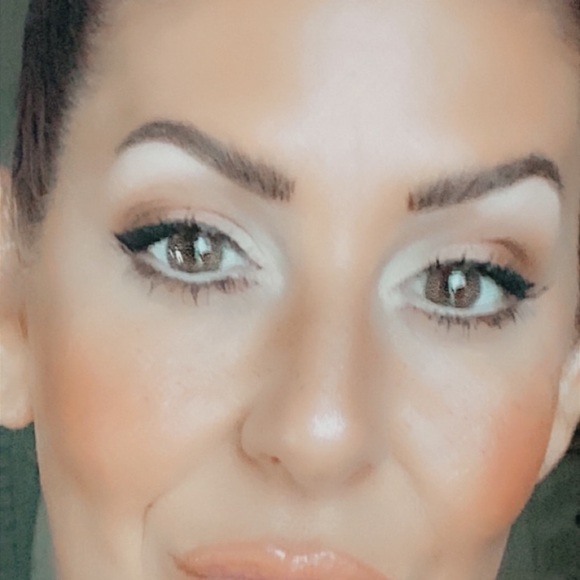 COPY - COPY - COPY - COPY - COPY - WONDERTOX 100 units - Picture 3 of 5